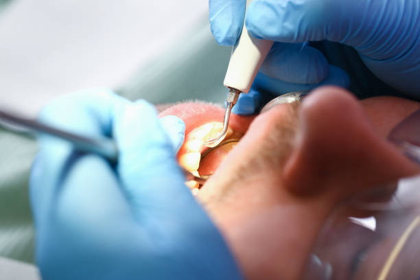 Best Urgent Dental Care for Toothache in Columbia, MS